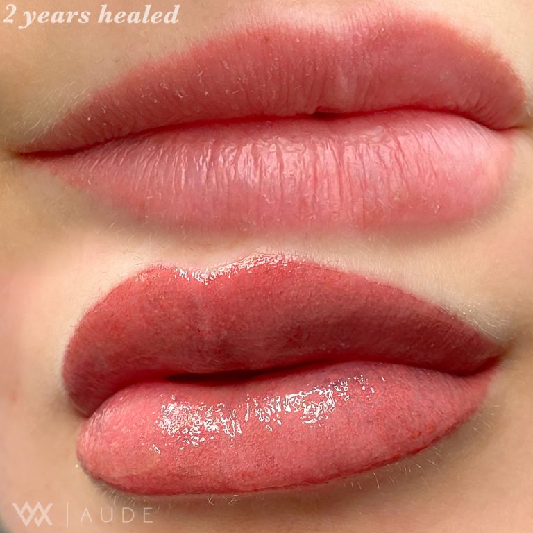 lip healed